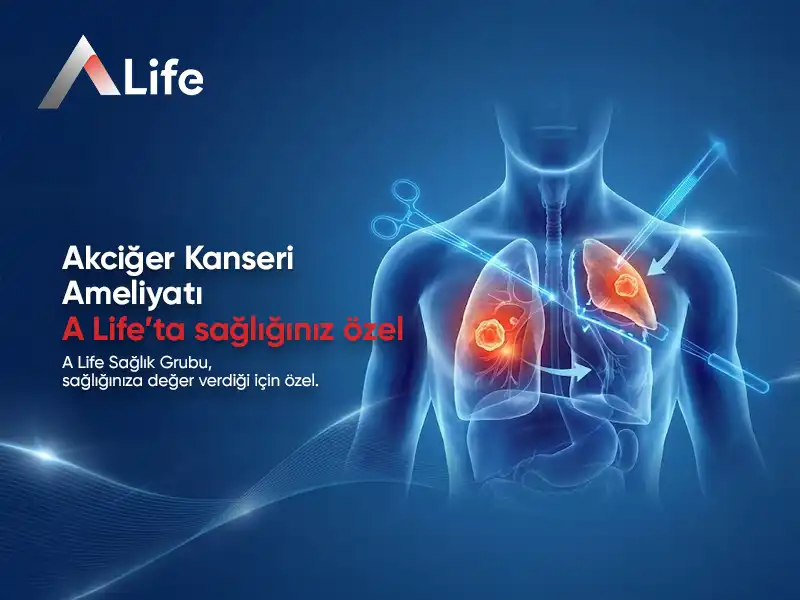 Akciğer Kanseri Ameliyatı | Neden ve Nasıl Yapılır?